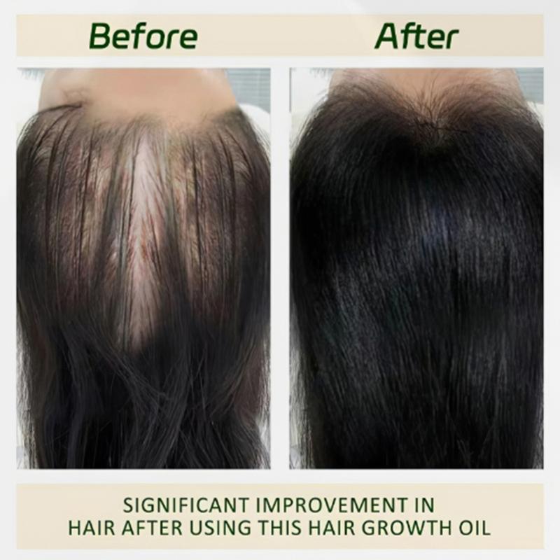 VGO Rosemary Mint Hair Strengthening Oil, 30ml   1.01oz Haircare  Lightweight