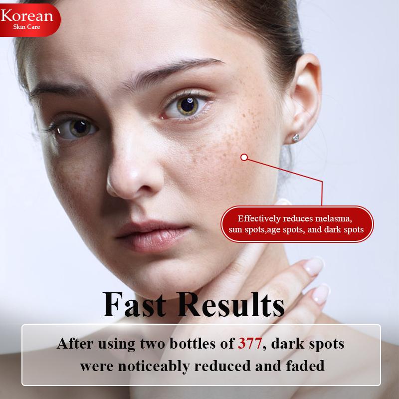 Dark Spot Correcting Serum, Niacinamide 10% + 377 1% + Vitamina C 1%, ZMbeauty Korean Skin Care for Melasma Sunspots Age Spots and Hyperpigmentation