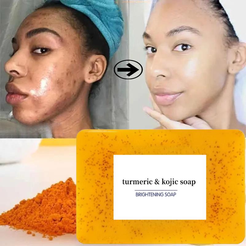 Turmeric & Kojic AcidBrightening Soap, Kojic Acid Soap, SoapBody Care Body Wash Lemon FlawlessOrganic Facial Cleansing Skincare SkinRepair Comfort