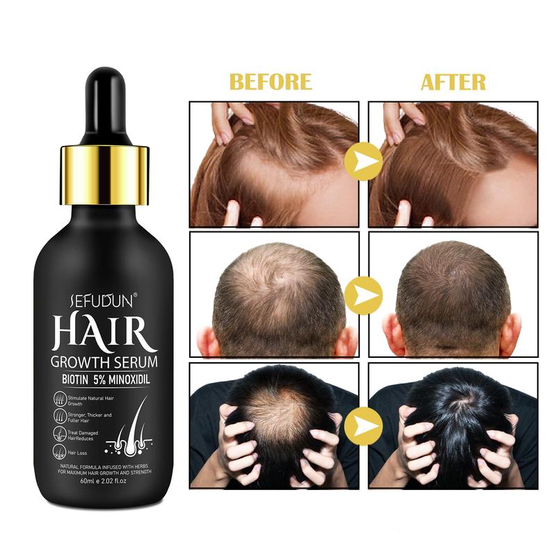 SEFUDUN Μinoxidil Hair Serum for Men & Women - Boosts Hair Health and Thickens for Growth