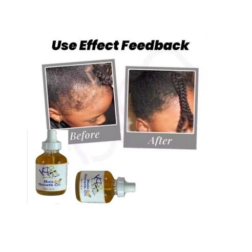 KZP Kids Hair Growth Oil Haircare Luxury