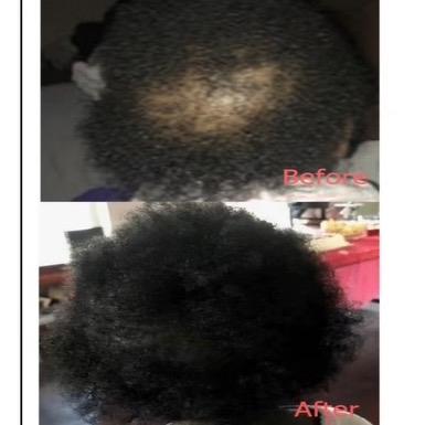 KZP Kids Hair Growth Oil Haircare Luxury