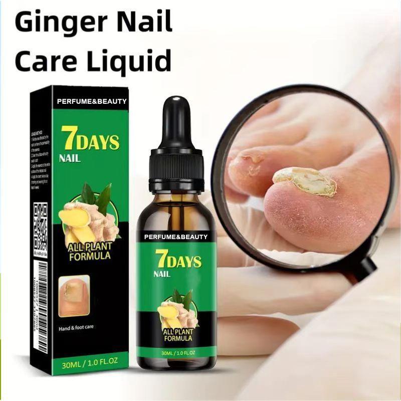 [Free Shipping]Ginger Nail Treatment Nail Support Nail Care