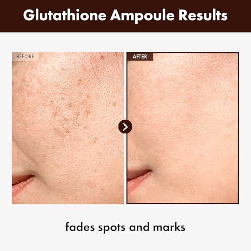 TOSOWOONG Glutathione Serum with Niacinamide and Hyaluronic Acid, 30ml - Dark Spot and Skin Repair - Moisturizers