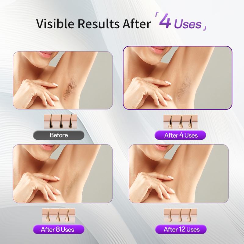 Sapphire ice-cooling IPL Laser Hair Removal Device 4 Sessions For Visible Results Effective 550nm Smooth Comfort ipl ice cool hair removal device laser ipl Home IPL pain  free Portable IPL IPL Hair