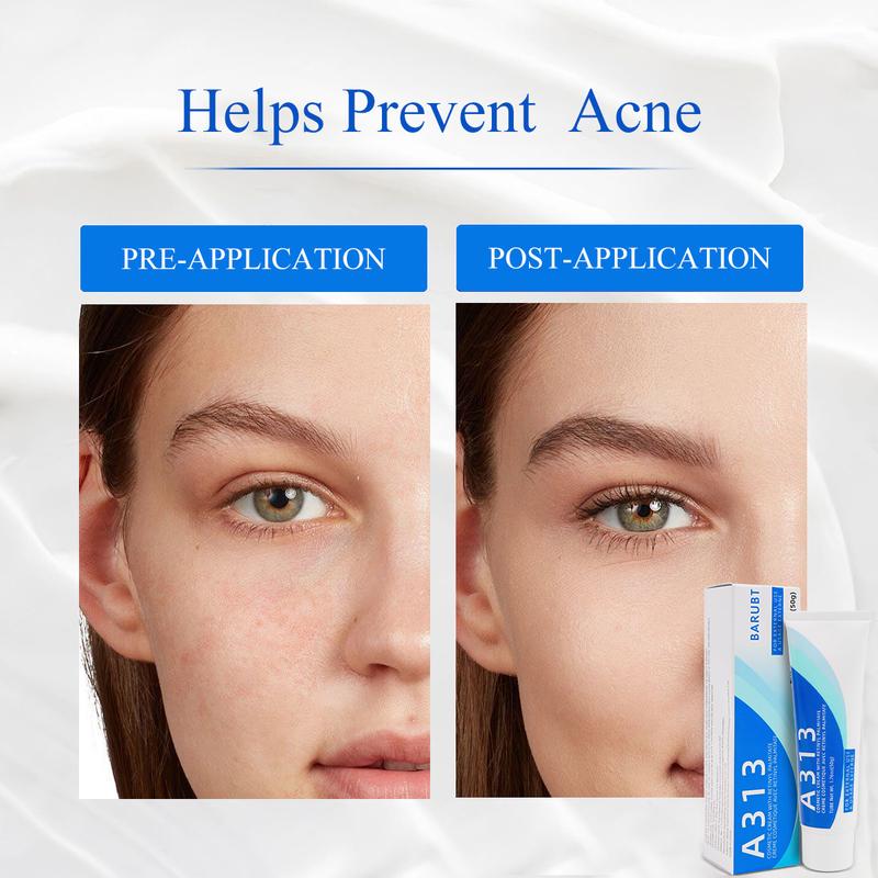 (New) 2024  A313 Vitamin A Pommade 200.000 UI - Skin Improvement Cream