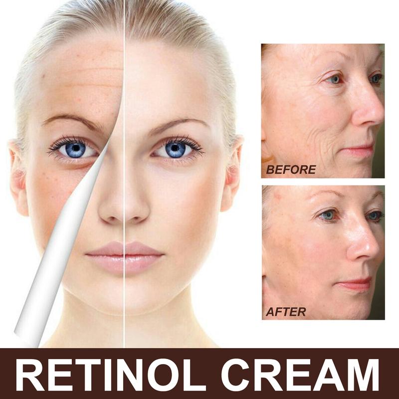 EELHOE  Retinol Cream: Anti-aging, firming, brightening, moisturizing facial skin cream