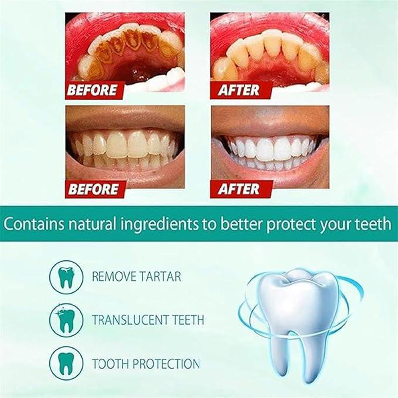 [+5$Get 2Pcs] SP-6 Probiotic Toothpaste Enhanced Formula Balances The Oral Microbiome, Removes Stains, And Provides Long-lasting Fresh Breath.