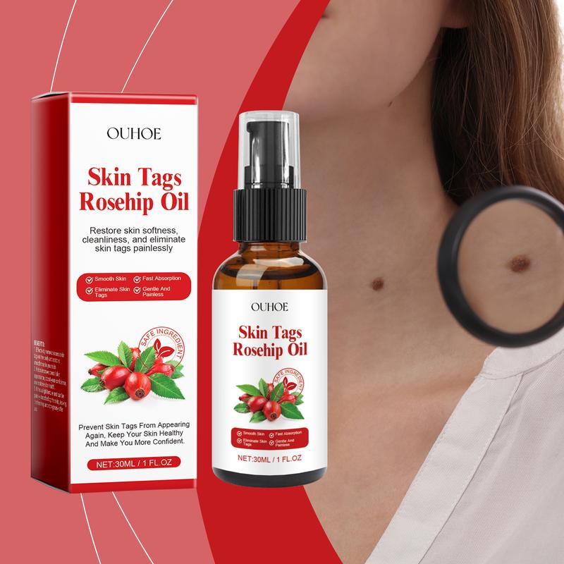 Rosehip Seed Wart Essence Oil Skin Label Repair and Fade Mole Corns Meat Pellet Essence Moisture Skincare