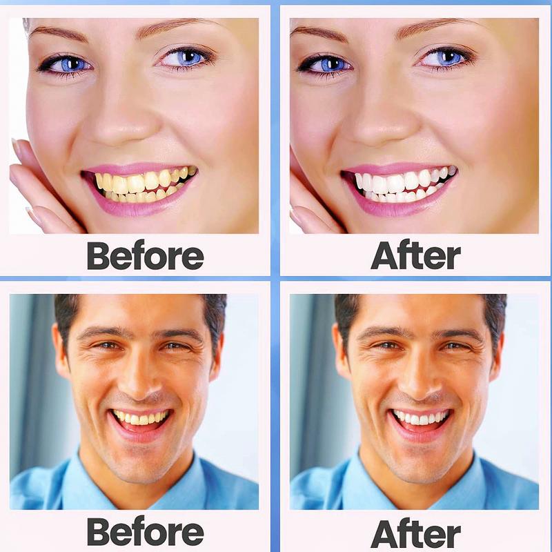 The original Whitening Strips,28pcs Effectively Reduced Sensitivity, Helps Remove Smoking Coffee Soda Wine Stain (14 Treatments)