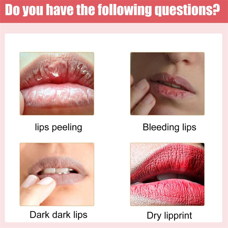 Lips Pink Fresh Lightening Bleaching Cream Treatment Remove Dark Smoke Lips Lip Balm Whitening Moisturizer Nourishing Essence