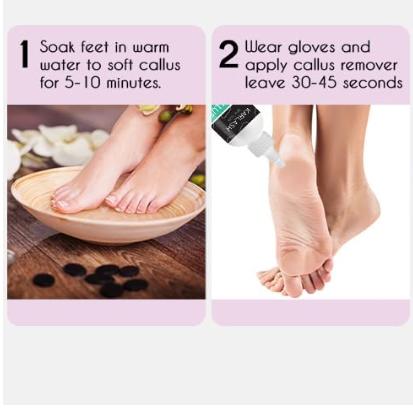 Professional B.est Callus Remover Gel for Feet and Foot Pumice Stone Scrubber Kit Remove Hard Skins Heels and Tough Callouses from feet Quickly and Effortless 4 oz (1 Bottle) Manicure Nail Nail Care Smooth